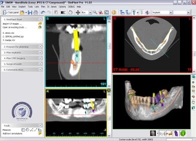 3d Diagnostik Röntgenbild