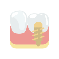 Implantat minimaler chirurgischer Eingriff