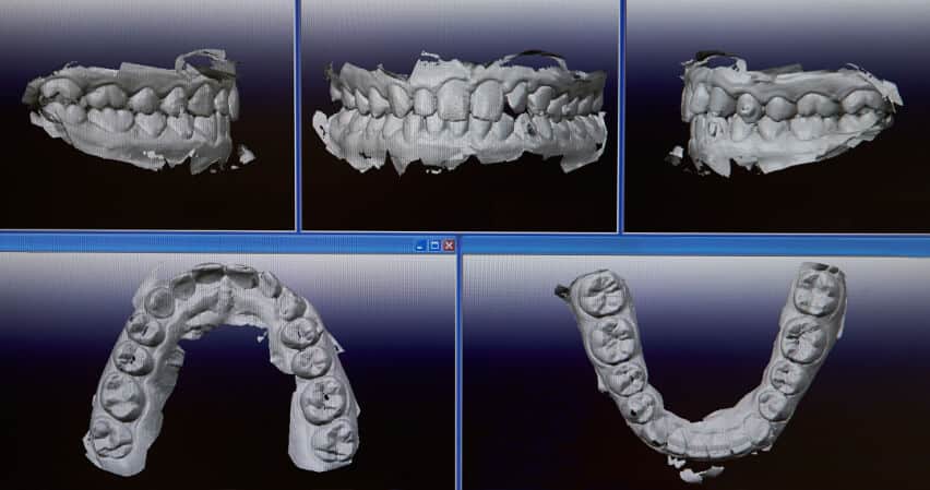 3D-diagnosetechnik-zahn-kieferstrukturen