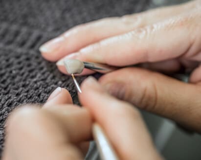 Zahntechniker bei der Herstellung von Keramik Veneers